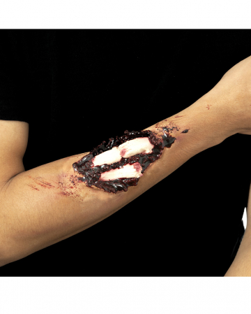 Bone Fracture Latex Wound 